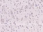 ATF Polyclonal Antibody