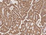 ATPIF1 Polyclonal Antibody