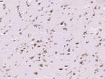 B3GAT3 Polyclonal Antibody