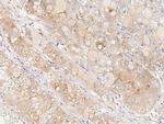 BAD Polyclonal Antibody
