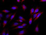 BCAS3 Polyclonal Antibody