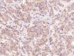 Beclin 1 Polyclonal Antibody