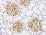 BST-2 Antibody in Immunohistochemistry (Paraffin) (IHC (P))