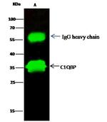 C1QBP Antibody in Immunoprecipitation (IP)