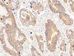 Carbonic Anhydrase XII Antibody in Immunohistochemistry (Paraffin) (IHC (P))