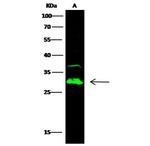 Carbonic Anhydrase II Polyclonal Antibody