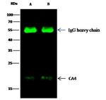 Carbonic Anhydrase IV Antibody in Immunoprecipitation (IP)