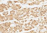 Carbonic Anhydrase IX Antibody in Immunohistochemistry (Paraffin) (IHC (P))