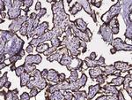 Calreticulin Antibody in Immunohistochemistry (Paraffin) (IHC (P))