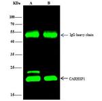 CRHSP-24 Antibody in Immunoprecipitation (IP)