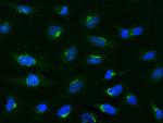 MCP-1 Polyclonal Antibody