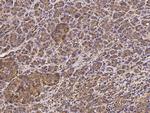 CD164 Antibody in Immunohistochemistry (Paraffin) (IHC (P))
