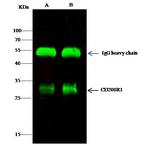 CD200R Antibody in Immunoprecipitation (IP)