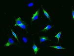 CD22 Polyclonal Antibody
