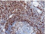 CD5 Polyclonal Antibody