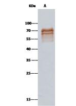 CD5 Antibody in Immunoprecipitation (IP)