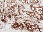 CD74 Antibody in Immunohistochemistry (Paraffin) (IHC (P))