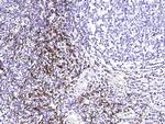 CD8 beta Antibody in Immunohistochemistry (Paraffin) (IHC (P))