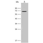 CDC25B Polyclonal Antibody
