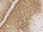 CDC37 Polyclonal Antibody