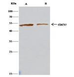 CDC37 Antibody in Immunoprecipitation (IP)
