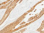 E-cadherin Antibody in Immunohistochemistry (Paraffin) (IHC (P))