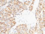 E-cadherin Antibody in Immunohistochemistry (Paraffin) (IHC (P))