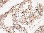 CDK3 Antibody in Immunohistochemistry (Paraffin) (IHC (P))