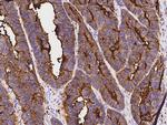CEACAM3 Polyclonal Antibody