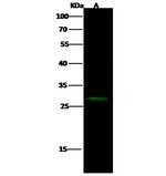 CER1 Polyclonal Antibody
