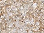 Cofilin Antibody in Immunohistochemistry (Paraffin) (IHC (P))