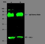 Cofilin Antibody in Immunoprecipitation (IP)