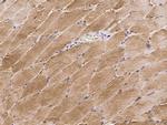 Cofilin 2 Antibody in Immunohistochemistry (Paraffin) (IHC (P))