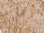 Cofilin 2 Antibody in Immunohistochemistry (Paraffin) (IHC (P))