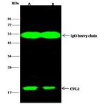Cofilin 2 Antibody in Immunoprecipitation (IP)
