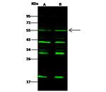 Chk1 Antibody in Western Blot (WB)