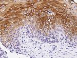 Claudin 4 Polyclonal Antibody