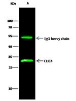 CLIC4 Antibody in Immunoprecipitation (IP)