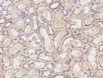 CLSTN1 Polyclonal Antibody