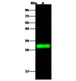 CMBL Polyclonal Antibody