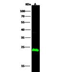 CMPK1 Polyclonal Antibody