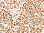 Carboxypeptidase A2 Polyclonal Antibody