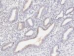 Carboxypeptidase M Polyclonal Antibody