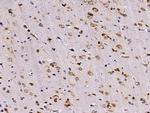 CRELD1 Polyclonal Antibody