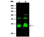 CRIP2 Antibody in Western Blot (WB)
