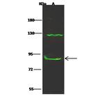 CTNNA3 Polyclonal Antibody