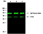 Cathepsin B Antibody in Immunoprecipitation (IP)