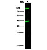 Cathepsin L Polyclonal Antibody