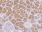 CUBN Polyclonal Antibody