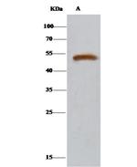 DARS Antibody in Immunoprecipitation (IP)
